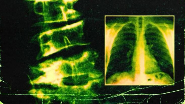 Biohazのバナー