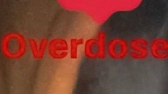 overdose shawtyのバナー
