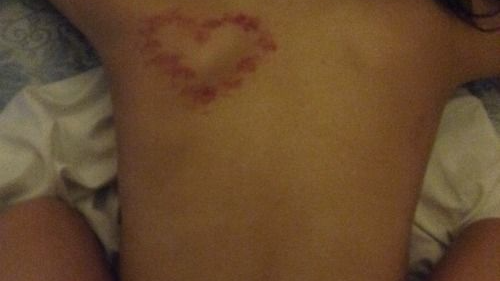 We love heart hickeys