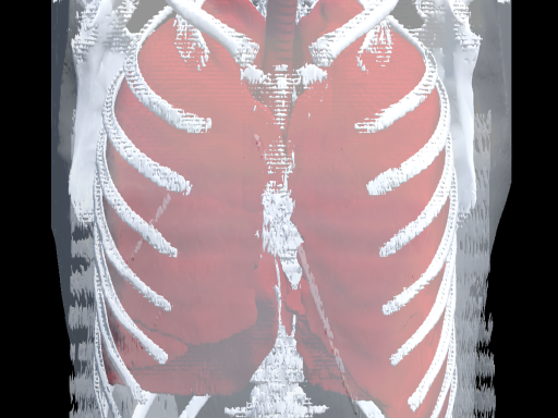 CT-SCAN